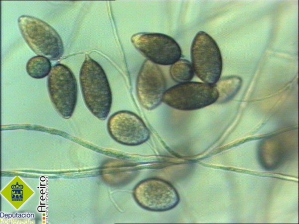 Phytophthora ramorum - Esporangios de Phytophthora ramorum.jpg
